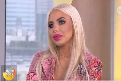 Polska Barbie w Dzień dobry TVN! Przez te wielkie usta dziewczyna ledwo co może mówić!
