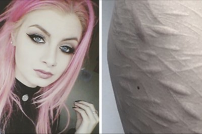 Żaden tatuażysta nie chciał zakryć blizn szpecących ciało tej 19 latki! Poza tym jednym! 