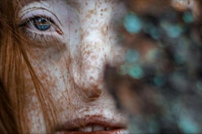 Gdy miała 16 lat musiała przejść ciężką operację! Zdjęcie jej niemal nagiego ciała odbiera mowę!