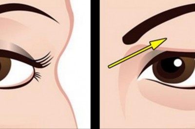 Poznaj prosty sposób na opadające powieki! Dzięki tej naturalnej metodzie unikniesz chirurga plastycznego!