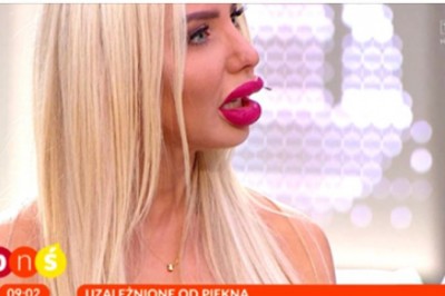 Polskiej Barbie puściły nerwy! Awantura z chirurgiem w „Pytaniu na śniadanie”!