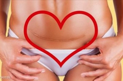 Trzy prawdy o cesarskim cięciu, które powinna poznać kobieta! To wymaga więcej odwagi niż myślisz!