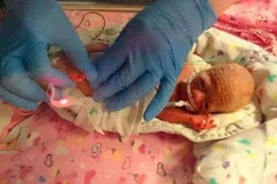 Wcześniak umiera lekarzowi na rękach! Podjął więc kontrowersyjną decyzję, by ratować jej życie!