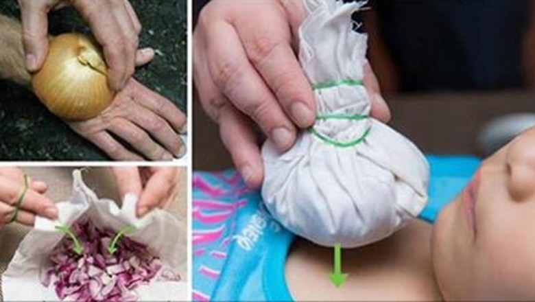 12 mało znanych zastosowań cebuli w medycynie naturalnej! Sprawdzone i w pełni naturalne!