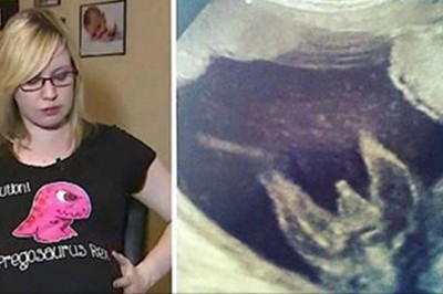 Rodzice spodziewali się zwykłej ciąży! Po badaniu USG nie byli w stanie uwierzyć w słowa lekarza! 