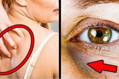 12 objawów sygnalizujących, że spożywasz za dużo cukru! To może być  niebezpieczne dla zdrowia!