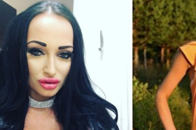 Ciężko uwierzyć jak wyglądała przed operacjami! Małgosia Godlewska 6 lat temu była blondynką! 