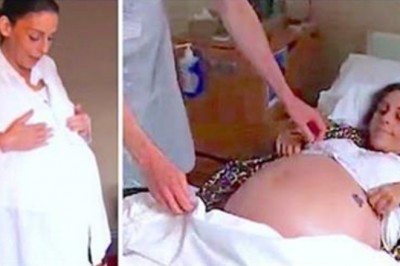 Wszyscy sądzili, że ta 35 letnia alkoholiczka jest w ciąży! Ale to nie dziecko było w jej ogromnym brzuchu!