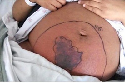 Ciężarną obudziła się z okropny bólem brzucha! Gdy spojrzała w dół, zauważyła, że chodzi po 