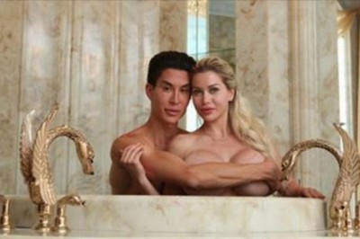 Wydali ponad 500 tys. dolarów, żeby wyglądać jak Ken i Barbie! Para uzależniona od operacji plastycznych!