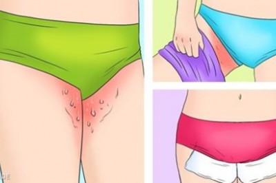 5 domowych sposobów na grzybicę skóry, które naprawdę działają! Warto skorzystać z naturalnych metod!