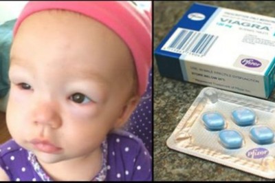 Rodzice podali maleńkiej córeczce viagrę! Wszystko na zalecenie lekarza by ratować jej życie! 