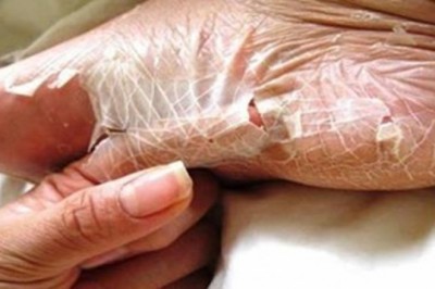 8 niezwykłych rzeczy, które potrafi zrobić Twoje ciało. O większości z nich ludzie nie mają pojęcia