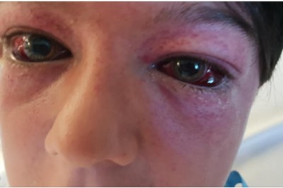 Gdy mama zobaczyła swojego 11-letniego syna w szpitalu, nie poznała go. Wszystko przez głupie wyzwanie z YouTube 