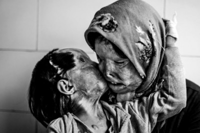 25 fascynujących zdjęć, które pokazują piękno i okrucieństwo naszego świata. Bardzo mocne