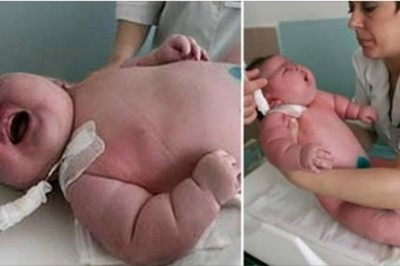 Ważąca 270 kg kobieta trafia w nocy do szpitala na porodówkę. Rodzi synka, którego waga to niemal 18 kg 