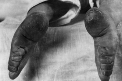 7 absurdalnych trendów w świecie mody z przeszłości. Kobiety dla piękna poświęcały naprawdę wiele 