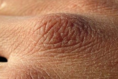 Sądzisz, że możesz spożywać za mało płynów? Poznaj 8 objawów, że pijesz za mało wody i Twoje ciało wysycha