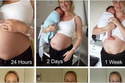 Odważna mama pokazała zdjęcia brzucha dzień po urodzeniu. 14 tygodni później zupełnie się zmienia