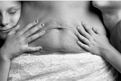 Fotograf pokazuje prawdziwe oblicze kobiecego ciała po przebytej ciąży. Tego nie zobaczysz w żadnym magazynie mody