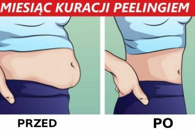 Nazywają to „wewnętrzny peeling jelit”. Dzięki temu zabiegowi możesz zrzucić nawet 4 kg