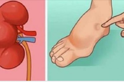 Twoje ciało ostrzega Cię na 24 godziny przed udarem. Zwróć uwagę na objawy, które mogą być niebezpieczne 