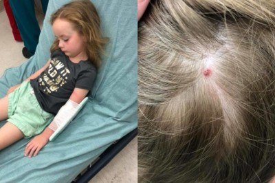 Zdrowa 5-latka nagle doznaje całkowitego paraliżu ciała. Przeczesując jej włosy znajduje coś nietypowego