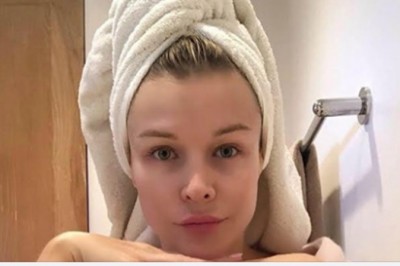 Joanna Krupa otwarcie przyznała, że jest nieuleczalnie chora. Jak mówi, mąż jest dla niej największym wsparciem