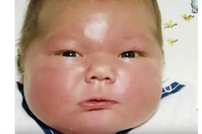 Kiedy się urodził ważył 7,5 kg. Dziś ma 35 lat i bardzo wyróżnia się na tle innych ludzi