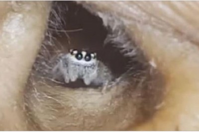 Skarżyła się na coraz dotkliwsze bóle głowy. U lekarza okazało się, że w jej uchu mieszka pająk