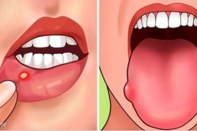 7 znaków świadczących o tym, że twój organizm ma braki kwasu foliowego. Zobacz jak je uzupełnić