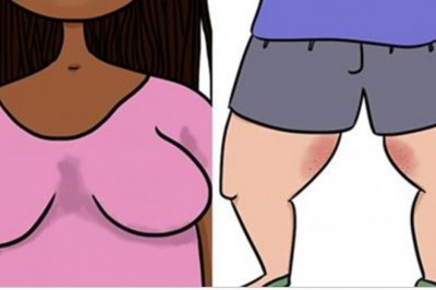 30 nieprzyjemnych sytuacji, które są zmora każdego lata. Mało kto głośno mówi