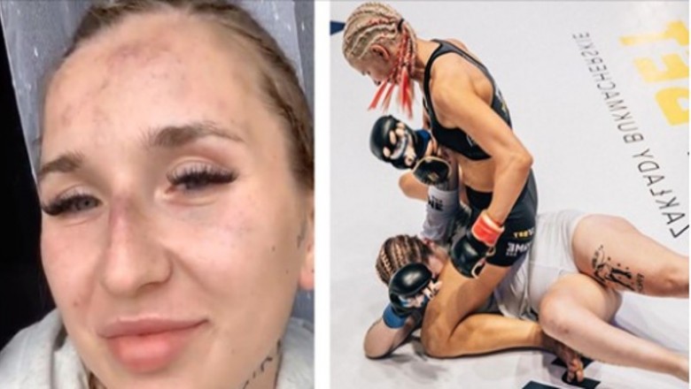 Marta Linkiewicz podzieliła się nagraniem po przegranej walce. Nie owijała w bawełnę
