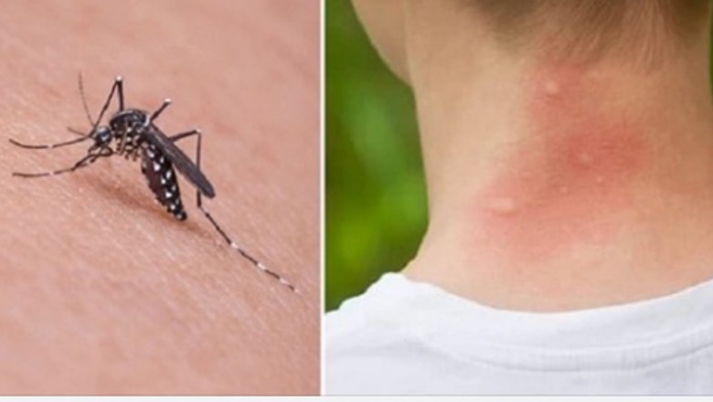 Komary gryzą Cię częściej niż innych? Biologia wyjaśnia czemu tak się dzieje