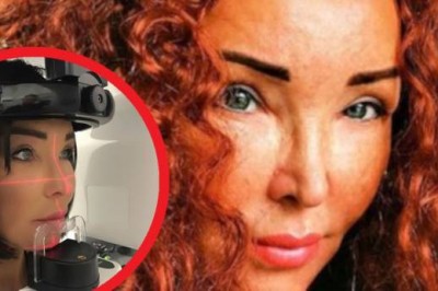 Ewa Minge szczerze o swojej twarzy. „To nie jest efekt operacji plastycznych”