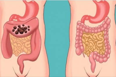 Poznaj bezpieczne metody na oczyszczenie jelita grubego i przedłużenie młodości