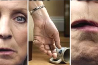 Udar daje 4 wczesne sygnały, które rozpoznasz. Ta wiedza ratuje życie