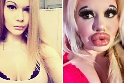 Powiększała usta już 15 razy. Potroiła już rozmiar swoich warg i chce więcej 