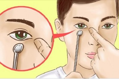 Nie możesz pozbyć się sińców pod oczami? Prosty domowy zabieg pomaga 