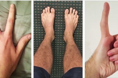 Ludzie dzielą się zdjęciami swoich niezwykłych części ciała. Biologia zaskakuje