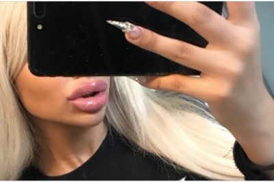 Postanowiła wyglądać jak Barbie. W wieku 13 lat miała pierwszy zabieg 