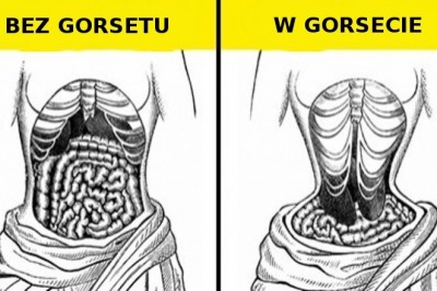 9 dziwacznych trendów mody z epoki wiktoriańskiej. Moda była ważniejsza od zdrowia
