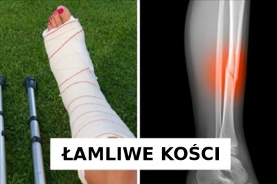 6 znaków świadczących o tym, że powinnaś przestać pić mleko