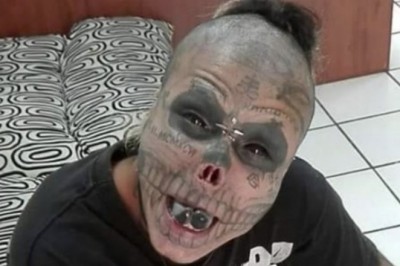 Usunął sobie uszy i nos, żeby wyglądać jak czaszka. Twierdzi, że dopiero teraz jest szczęśliwy