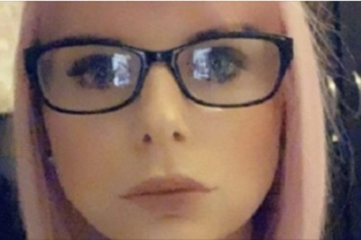 Powiększyła sobie usta u „domowej kosmetyczki”. Jej wargi powiększyły się 10-krotnie