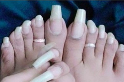 Zdjęcia najgorszych przykładów pedicure. Z tymi paznokciami musi być trudno chodzić