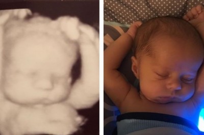 Po porodzie mama ogląda USG i dostrzega coś czego nikt nie zauważył wcześniej