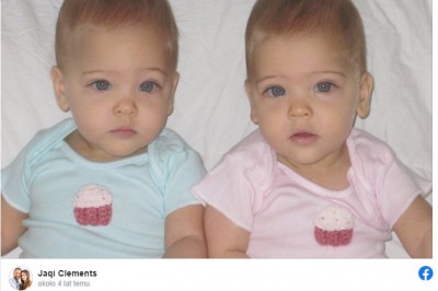 Urodziły się 10 lat temu. Dziś są uznawane za najpiękniejsze bliźniaczki w historii 