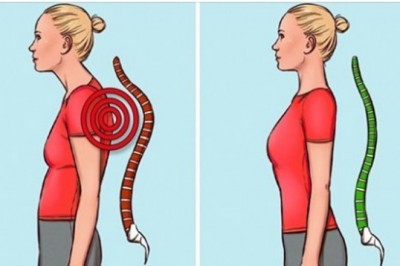 5 prostych ćwiczeń, które pomogą ci poprawić postawę i zapomnieć o bólu pleców