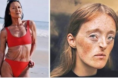 10 fascynujących cech wyglądu, które możesz zobaczyć raz w życiu. To prawdziwa rzadkość